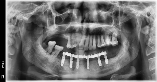 13524839664287236_7.png 13524839664287236_7.png