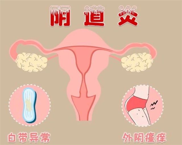 18134624161318962_103.jpg 18134624161318962_103.jpg